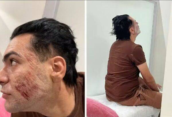 Empresário morreu durante procedimento de peeling de fenol - Foto: Reprodução